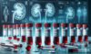 Kidney Blood Test Guide for Blackburn Residents: Essential Insights