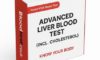 Advanced Liver Blood Test Guide for Maidstone Residents