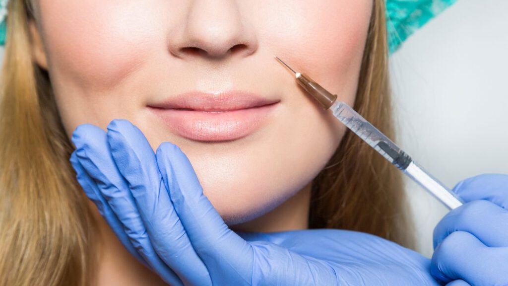 Lip Filler Simulation: Visualise Your Perfect Look!