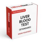 Liver Blood Test Essentials for Residents of Exeter
