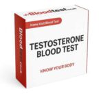 Low Testosterone Blood Test: What to Expect in Watford