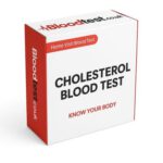 High Cholesterol Blood Test Guidance for Ashford Residents